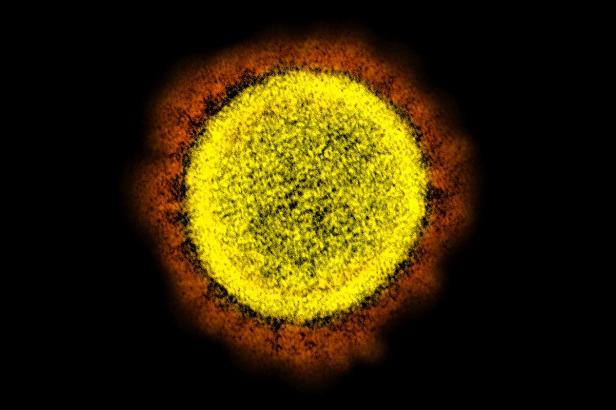 Diese vom US-amerikanischen National Institute of Allergy and Infectious Diseases zur Verfügung gestellte elektronenmikroskopische Aufnahme aus dem Jahr 2020 zeigt ein von einem Patienten isoliertes Partikel des neuartigen Coronavirus Sars-CoV-2 in einem Labor in Fort Detrick, Md. Die weithin als Stealth-Omicron bekannte Coronavirus-Mutante verursacht inzwischen mehr als ein Drittel der neuen Omicron-Fälle in der Welt. Foto: Keystone-SDA/ NIAID/NIH via AP Diese vom US-amerikanischen National Institute of Allergy and Infectious Diseases zur Verfügung gestellte elektronenmikroskopische Aufnahme aus dem Jahr 2020 zeigt ein von einem Patienten isoliertes Partikel des neuartigen Coronavirus Sars-CoV-2 in einem Labor in Fort Detrick, Md. Die weithin als Stealth-Omicron bekannte Coronavirus-Mutante verursacht inzwischen mehr als ein Drittel der neuen Omicron-Fälle in der Welt. Foto: Keystone-SDA/ NIAID/NIH via AP